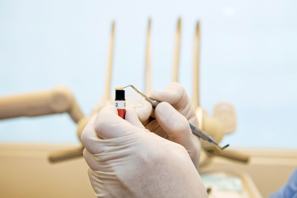 ankeny composite resin
