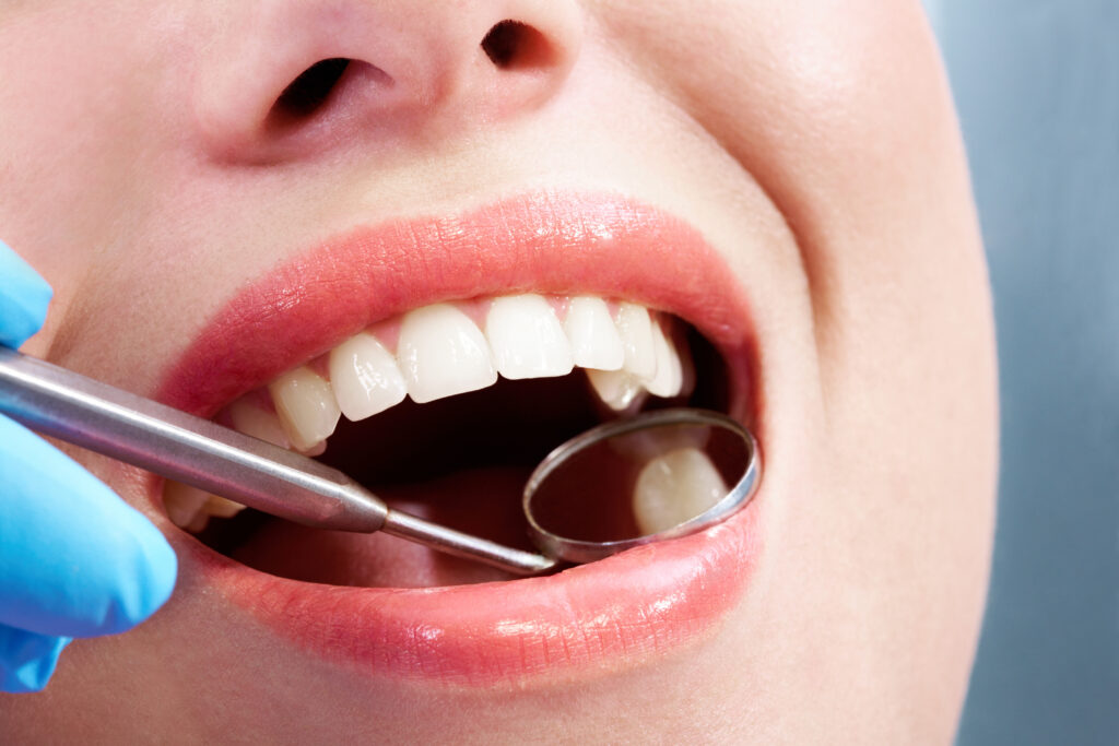ankeny dental cleaning
