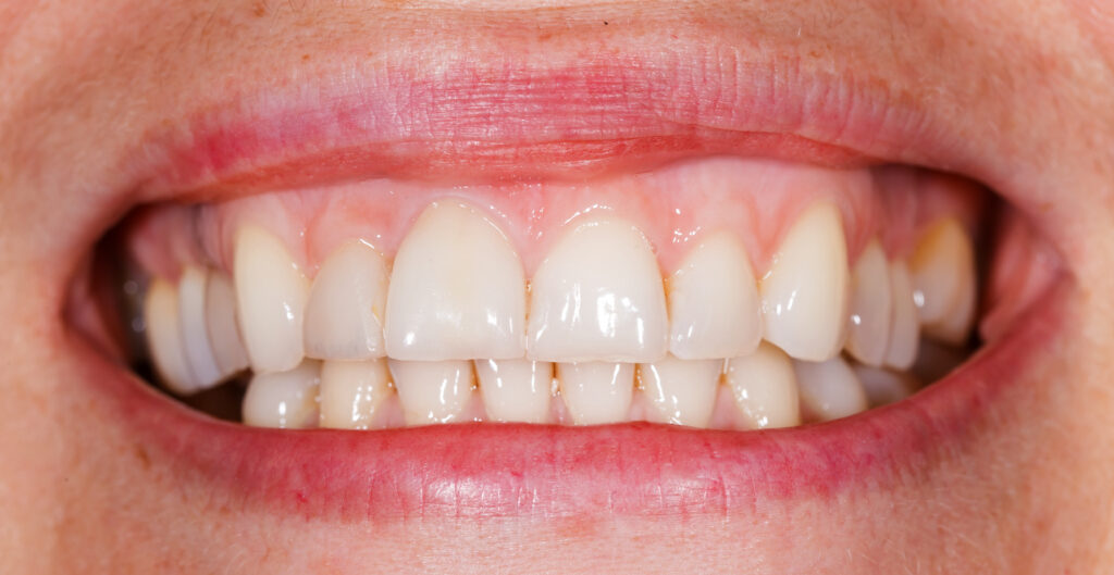 Ankeny, IA, dentist offers periodontal care