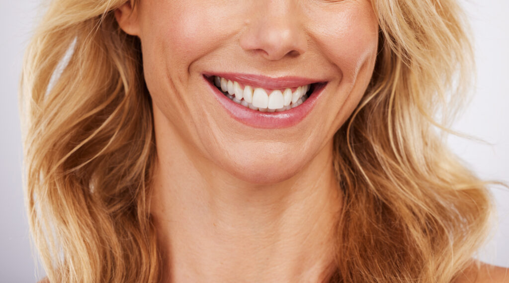 Ankeny, IA, dentist offers porcelain veneers