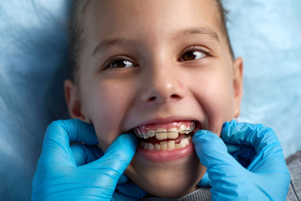ankeny children's dentistry