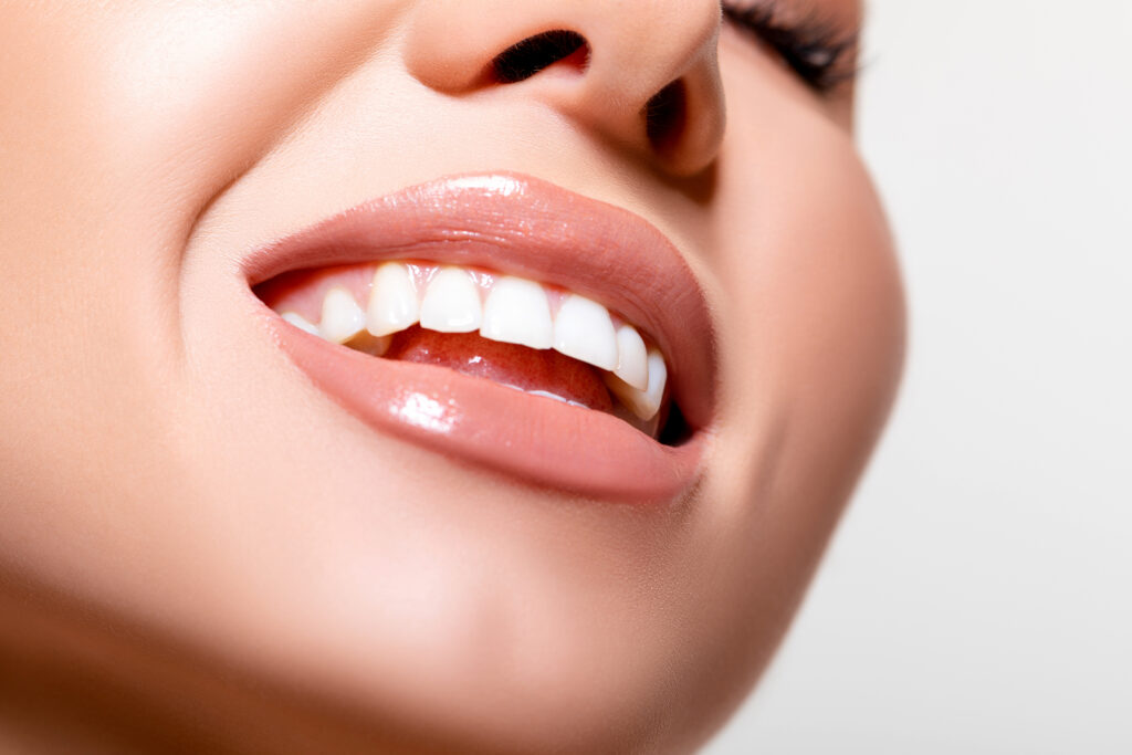 ankeny dental restorations