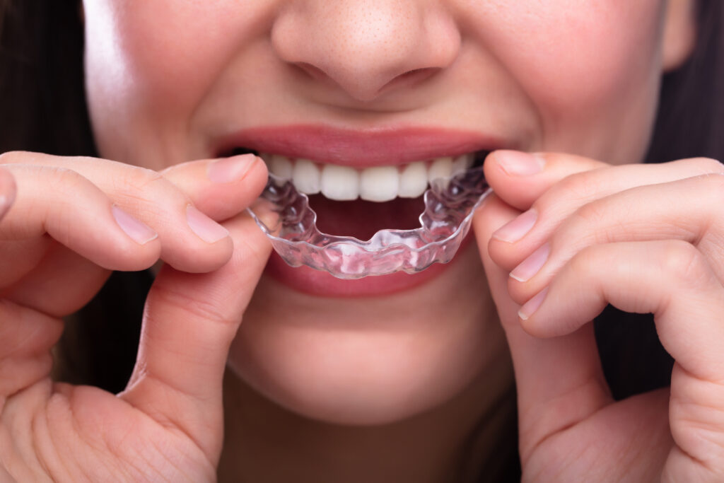 ankeny teeth grinding