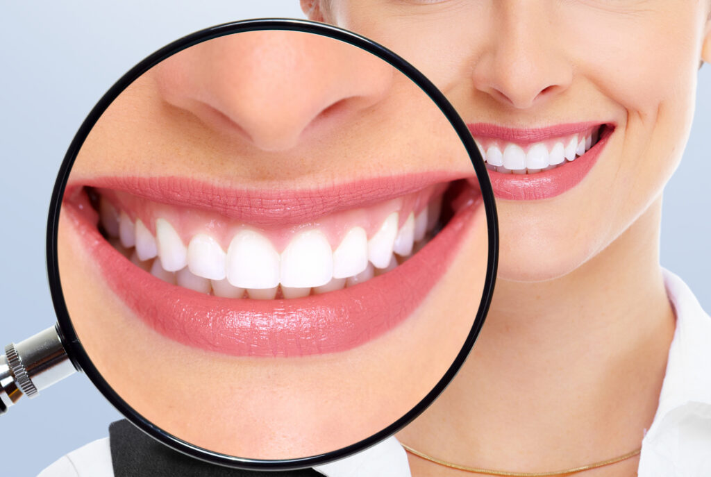 ankeny teeth whitening