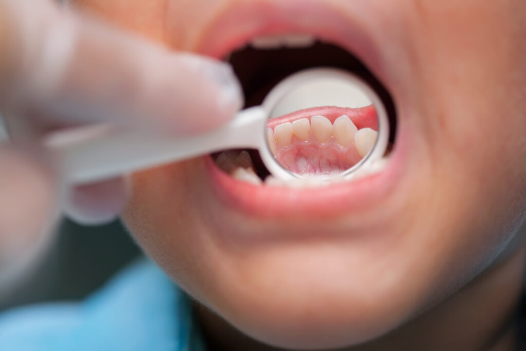 ankeny dental checkup